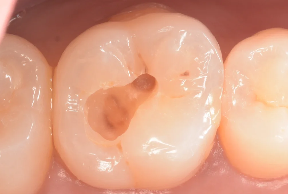 印西からお越しの方。|坂寄歯科医院(取手市藤代) - 画像2