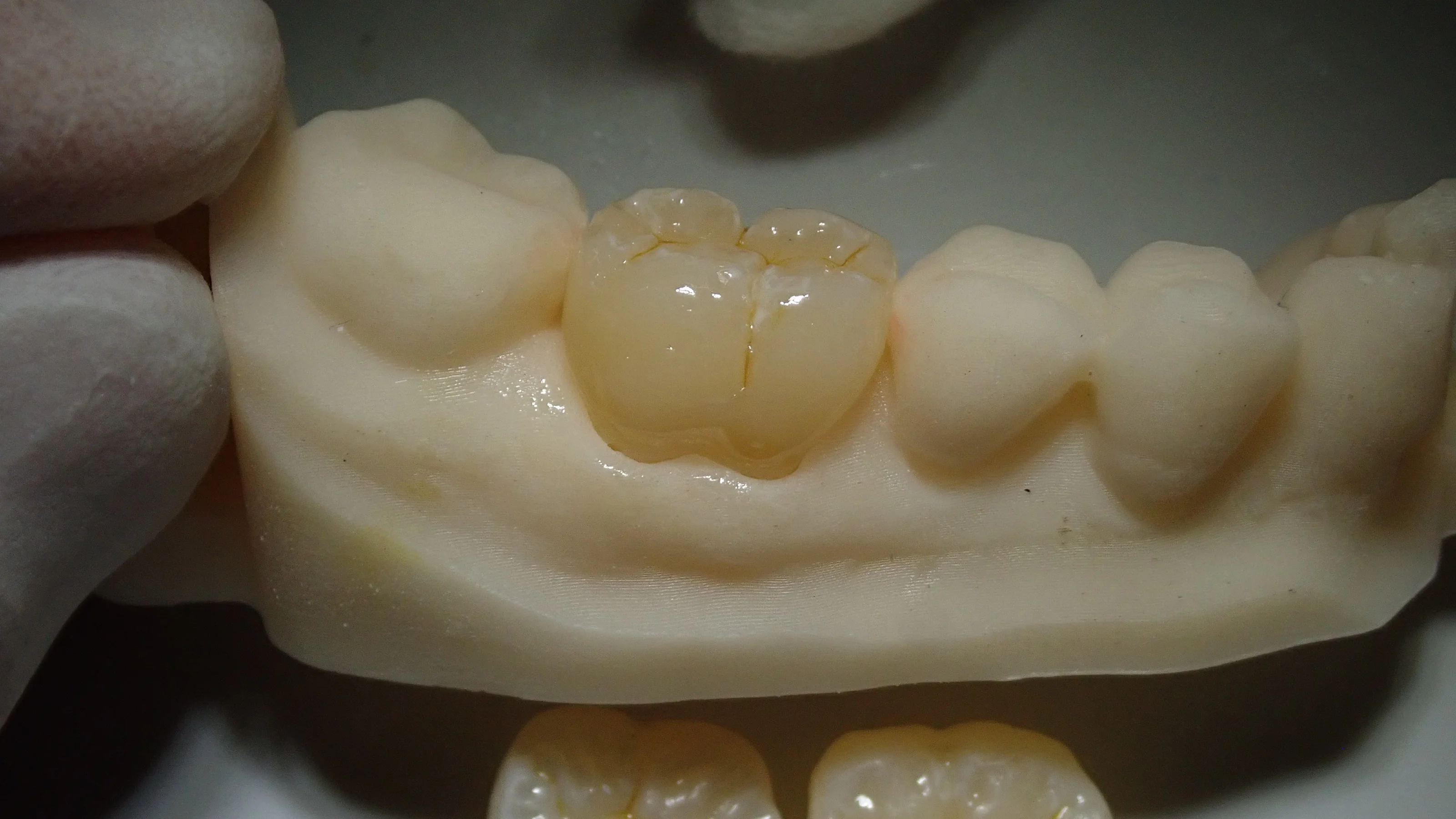 解剖学的知識を深め、更に治療精度を高めるために･･･｜坂寄歯科医院（取手市藤代） - 画像2