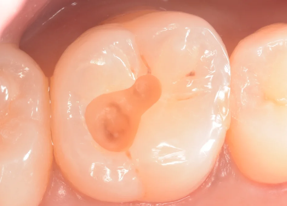 印西からお越しの方。|坂寄歯科医院(取手市藤代) - 画像3