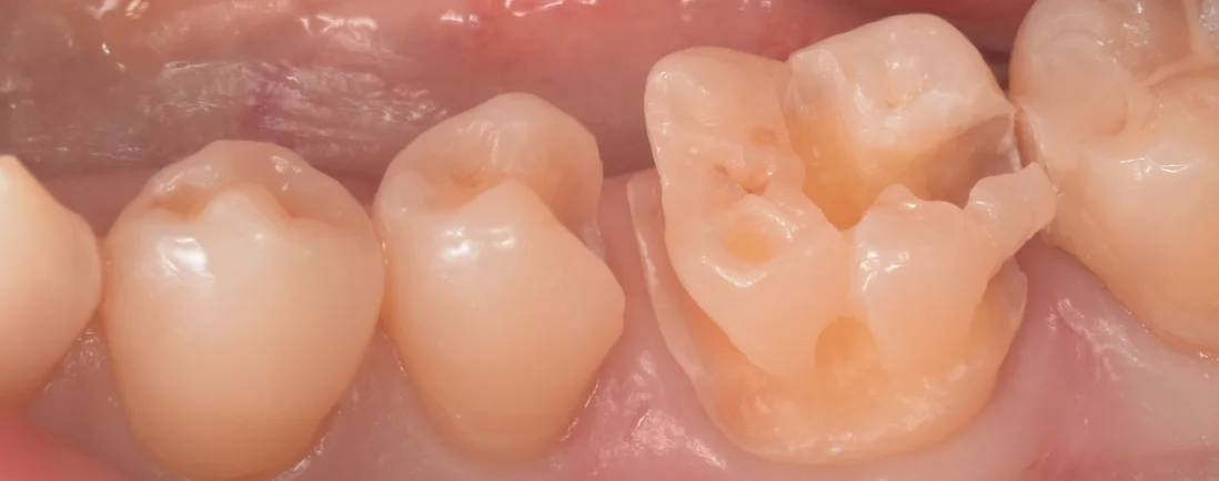 三鷹より来院された方|坂寄歯科医院(取手市藤代) - 画像6