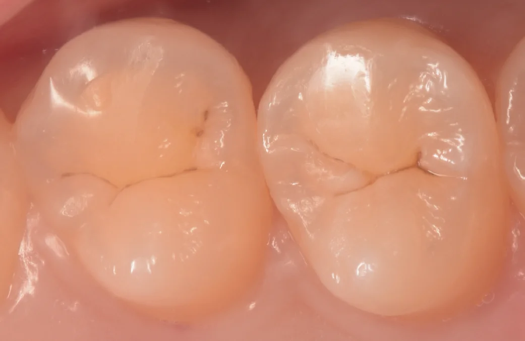 神奈川からお越しの歯科医師の方|坂寄歯科医院(取手市藤代)