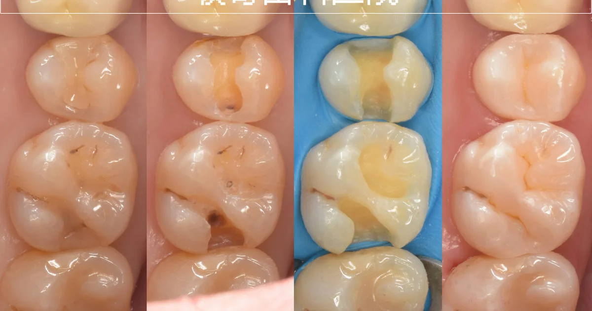 ブログ・お役立ち情報｜坂寄歯科医院（取手市藤代）