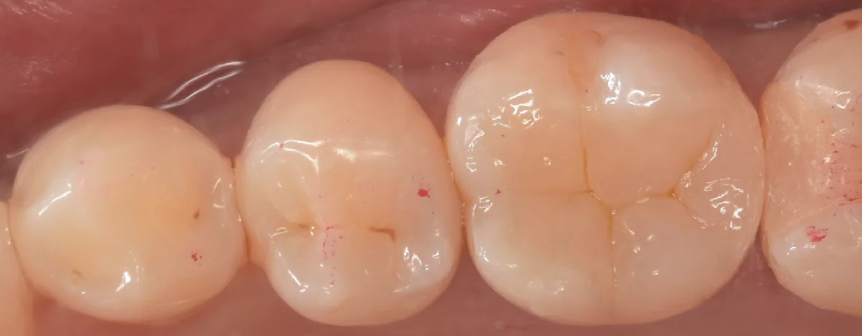 埼玉県からお越しの方｜坂寄歯科医院（取手市藤代） - 画像3