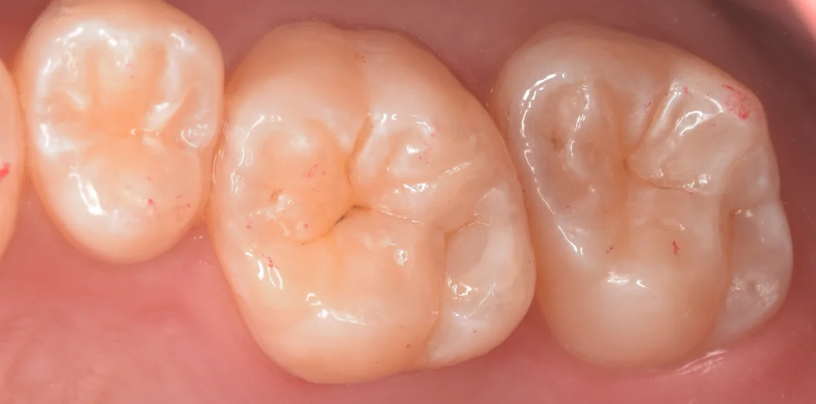 群馬からお越しの歯科医師の方。｜坂寄歯科医院（取手市藤代） - 画像4