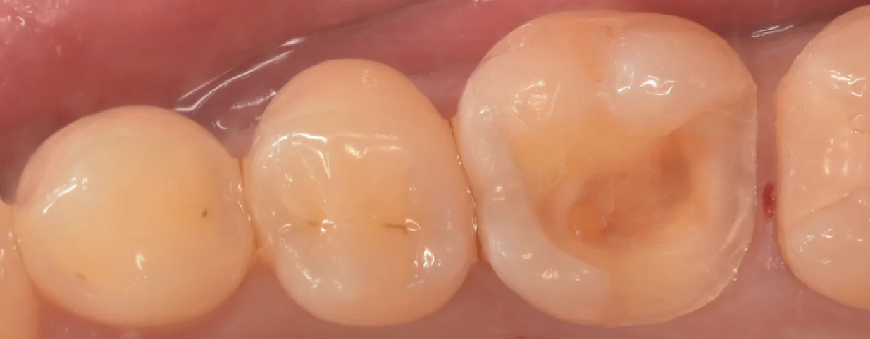 埼玉県からお越しの方｜坂寄歯科医院（取手市藤代） - 画像2