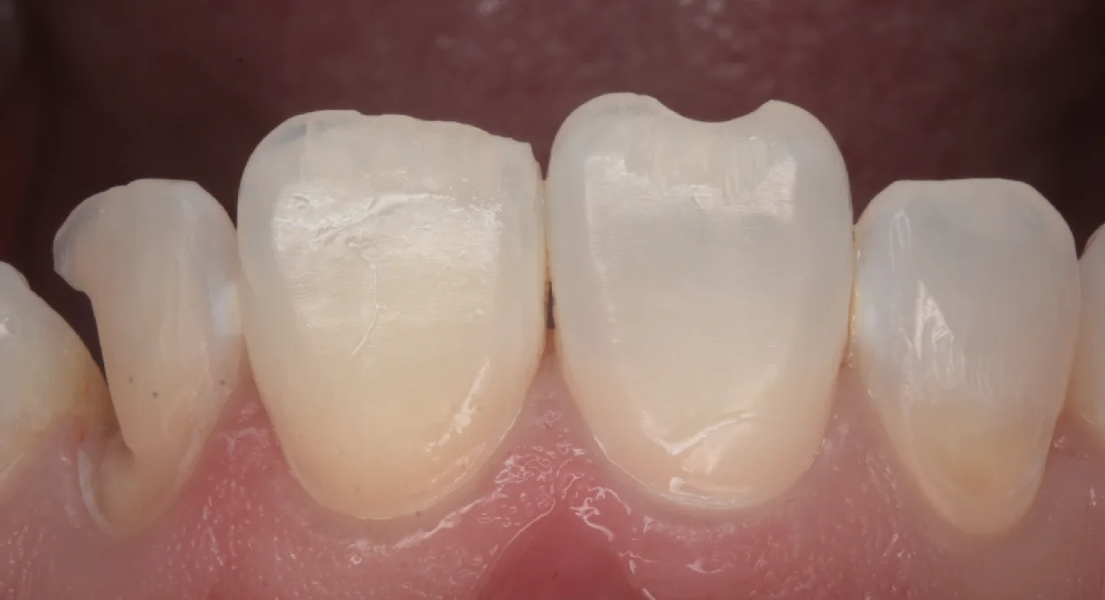 目黒からお越しの方|坂寄歯科医院(取手市藤代) - 画像2