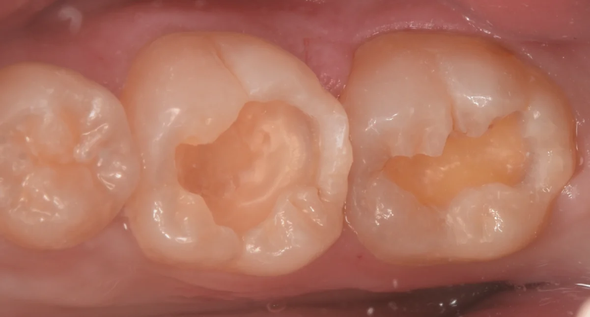 竜ヶ崎市からお越しの方。｜坂寄歯科医院（取手市藤代） - 画像3