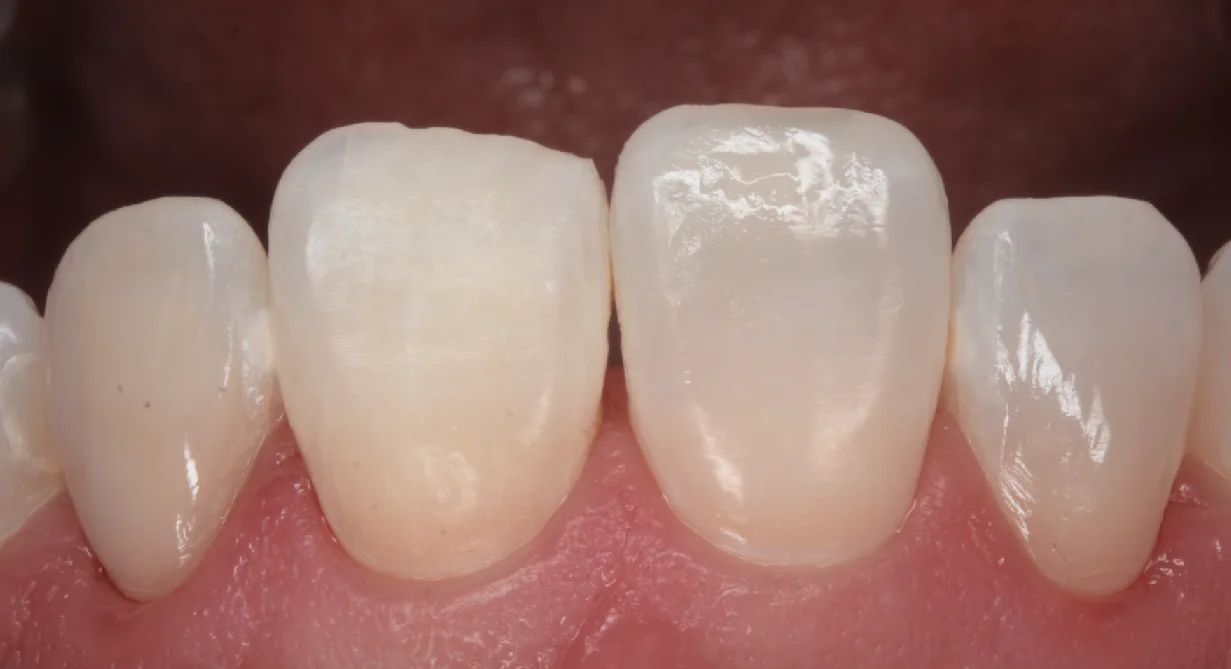 目黒からお越しの方|坂寄歯科医院(取手市藤代) - 画像4