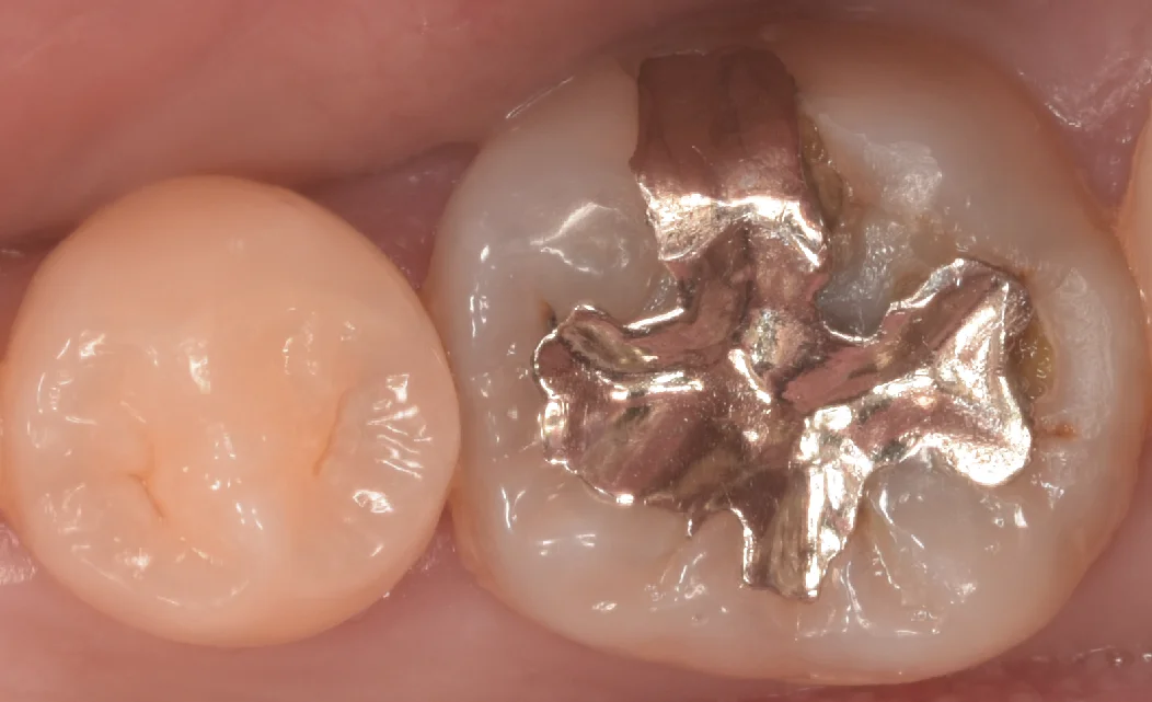 印西からお越しの方|坂寄歯科医院(取手市藤代)