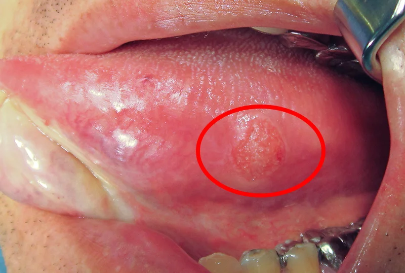それ・・・本当に不急ですかね・・・?|坂寄歯科医院(取手市藤代)