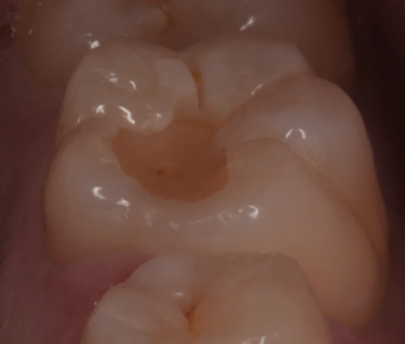 歯学部生をダイレクトで。|坂寄歯科医院(取手市藤代) - 画像2