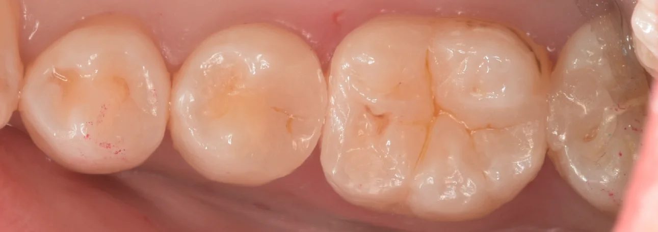 三鷹より来院された方|坂寄歯科医院(取手市藤代) - 画像7