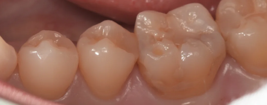 三鷹より来院された方|坂寄歯科医院(取手市藤代) - 画像2