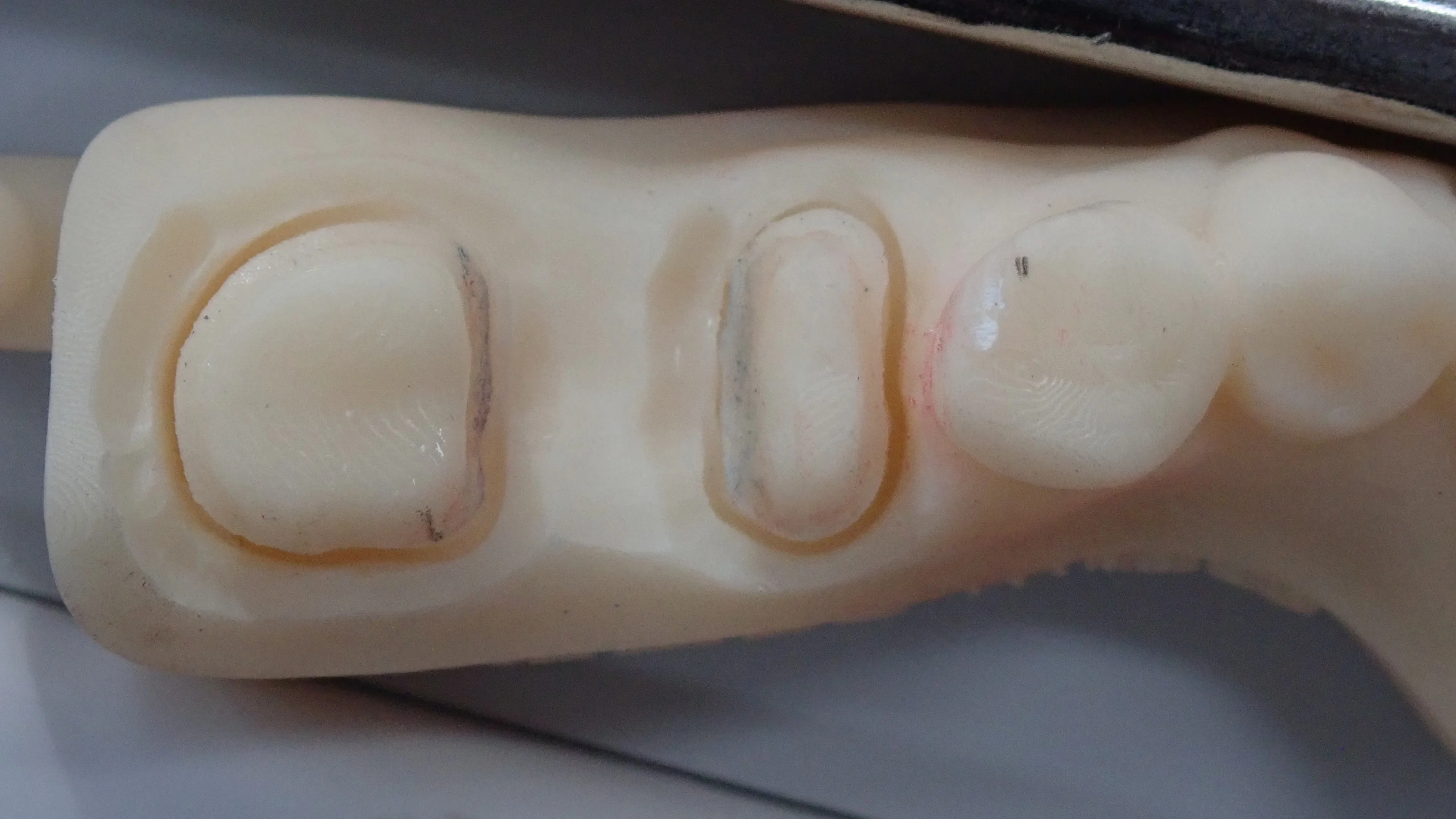 その抜歯ちょっと待って！｜坂寄歯科医院（取手市藤代） - 画像4