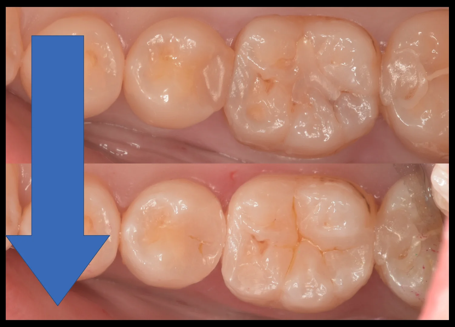 三鷹より来院された方|坂寄歯科医院(取手市藤代) - 画像9