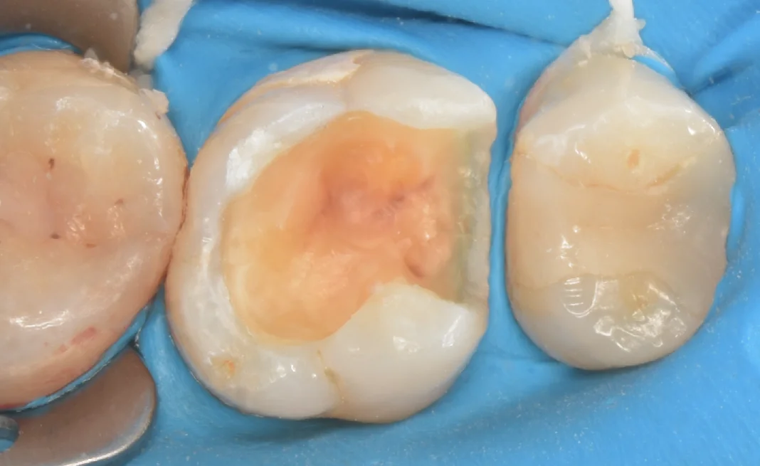 新宿からお越しの方|坂寄歯科医院(取手市藤代) - 画像2