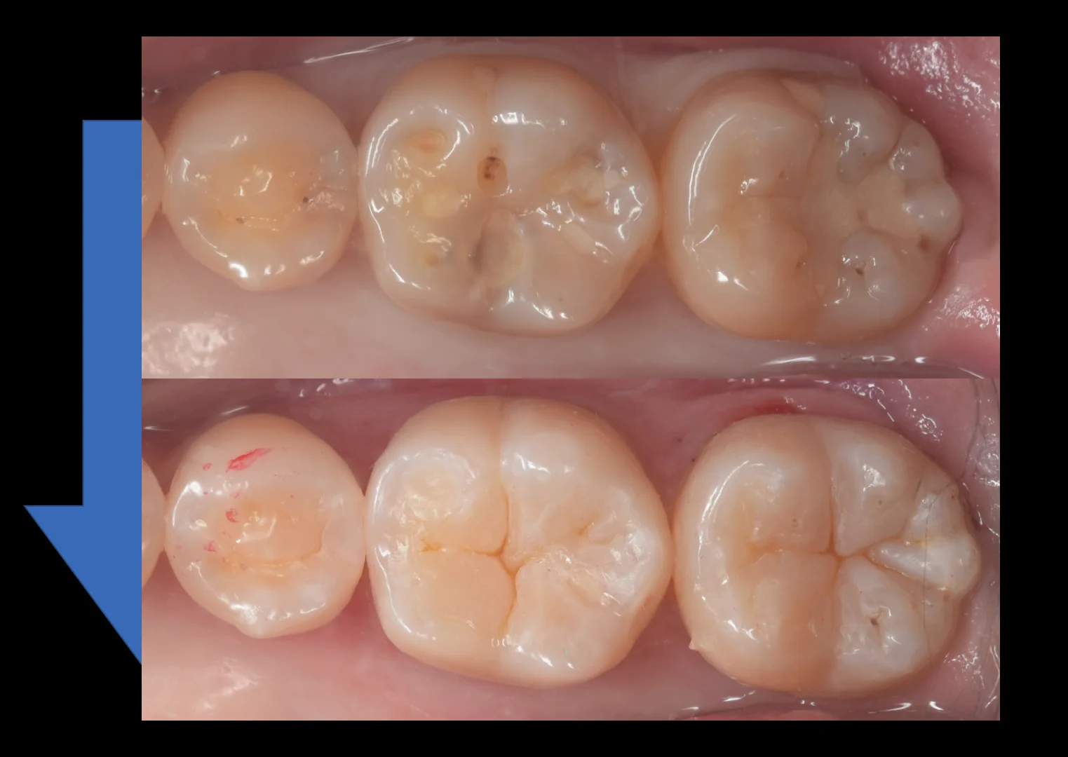 遠方からいらっしゃった歯科医師の方。|坂寄歯科医院(取手市藤代) - 画像5
