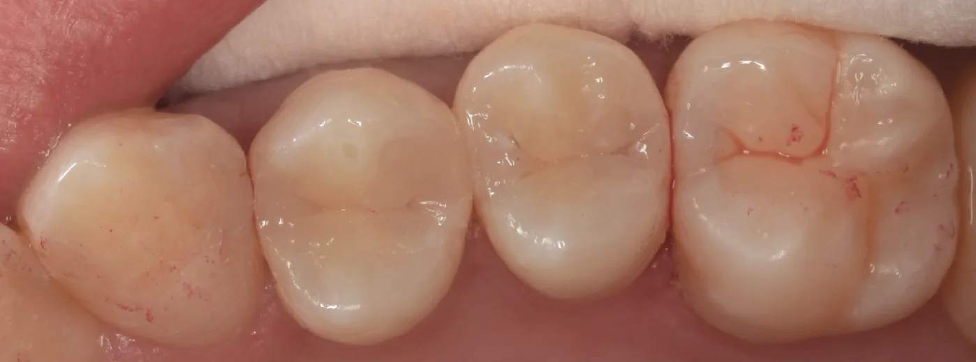 通常の保険診療。|坂寄歯科医院(取手市藤代) - 画像4