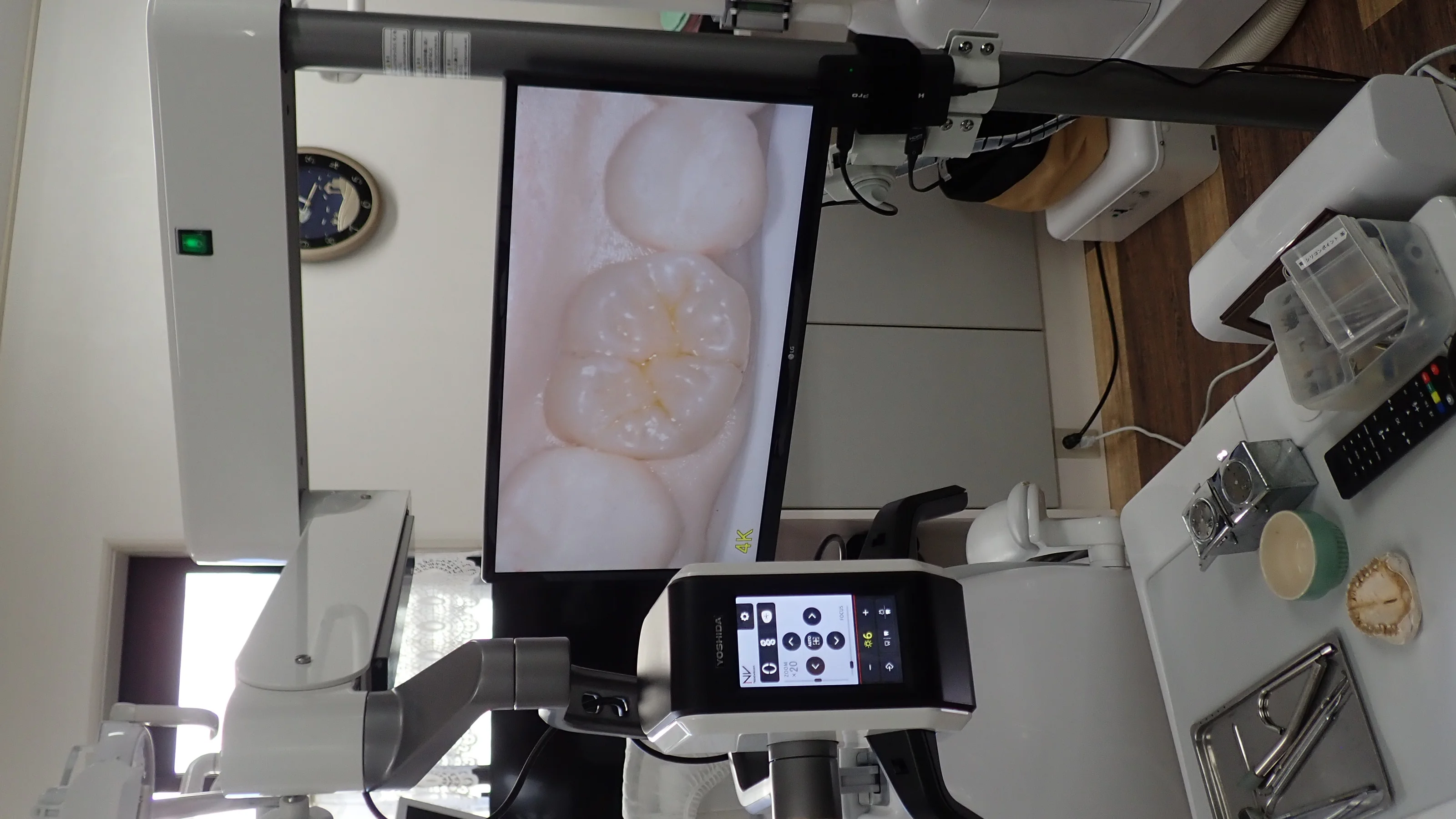 ネクストビジョン導入しました。|坂寄歯科医院(取手市藤代)