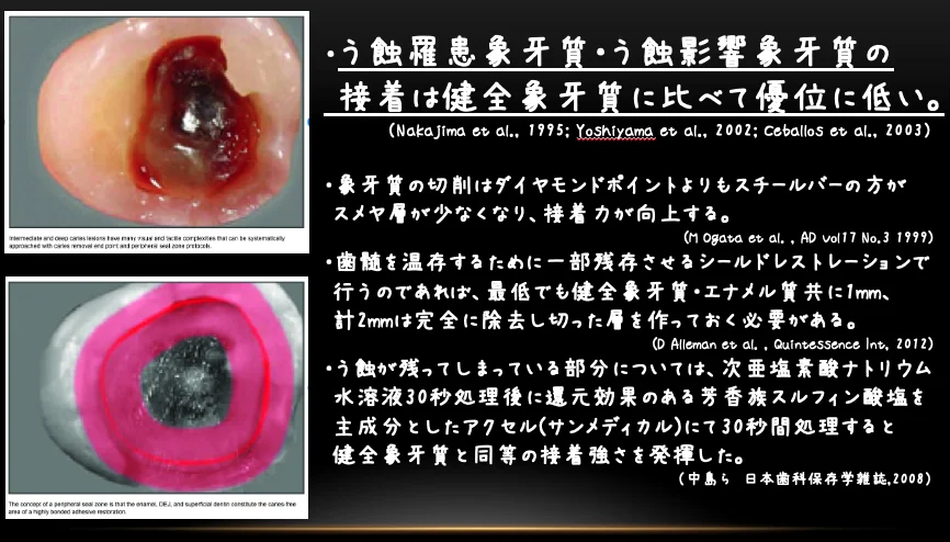 歯学部生をダイレクトで。|坂寄歯科医院(取手市藤代) - 画像4