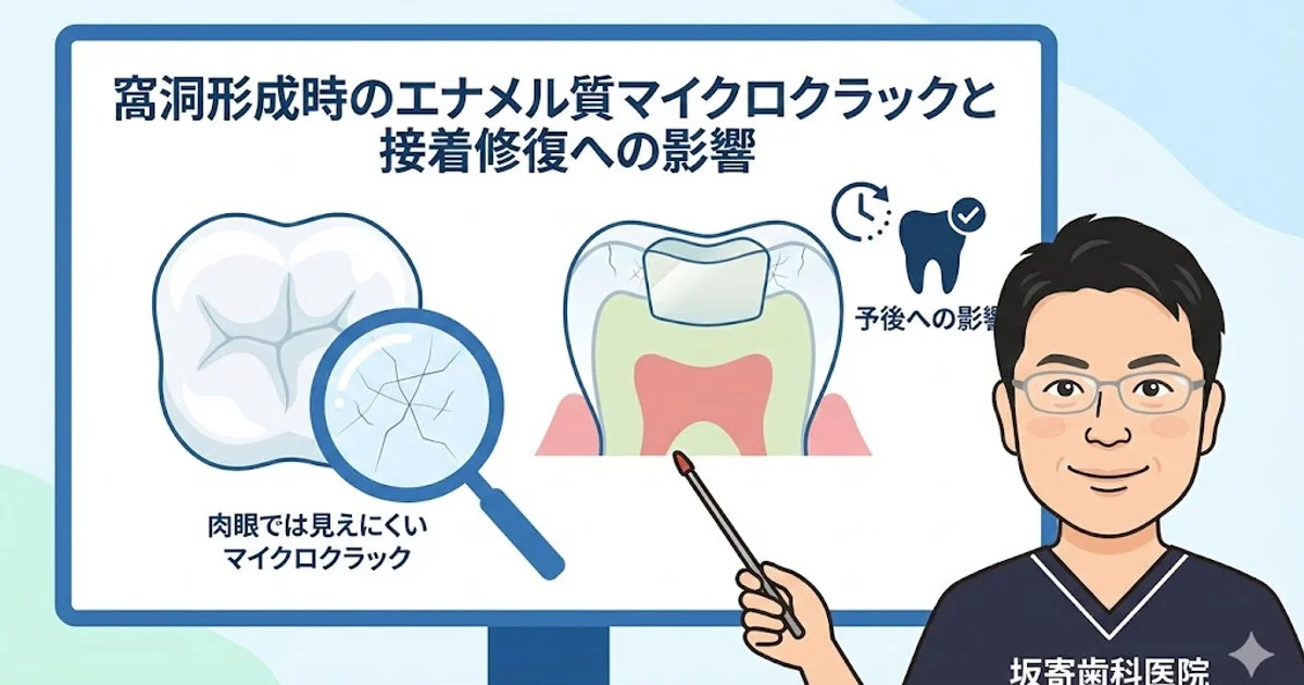 窩洞形成時のエナメル質マイクロクラックと接着修復への影響を、歯の拡大図と断面図、歯科医師イラストで解説する坂寄歯科医院の説明画像