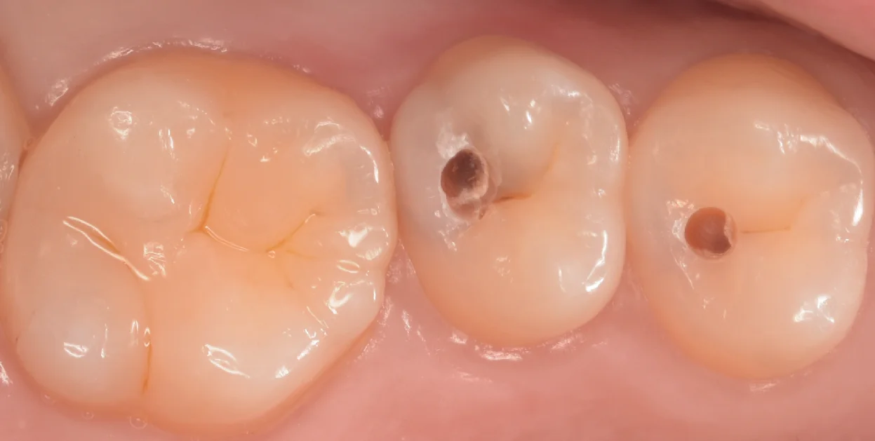 夢の国近辺から通院中の方。｜坂寄歯科医院（取手市藤代） - 画像2