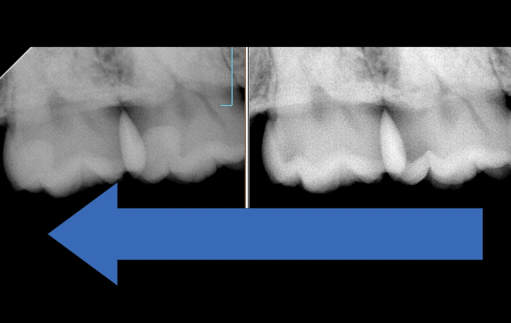 群馬からお越しの歯科医師の方。｜坂寄歯科医院（取手市藤代） - 画像6