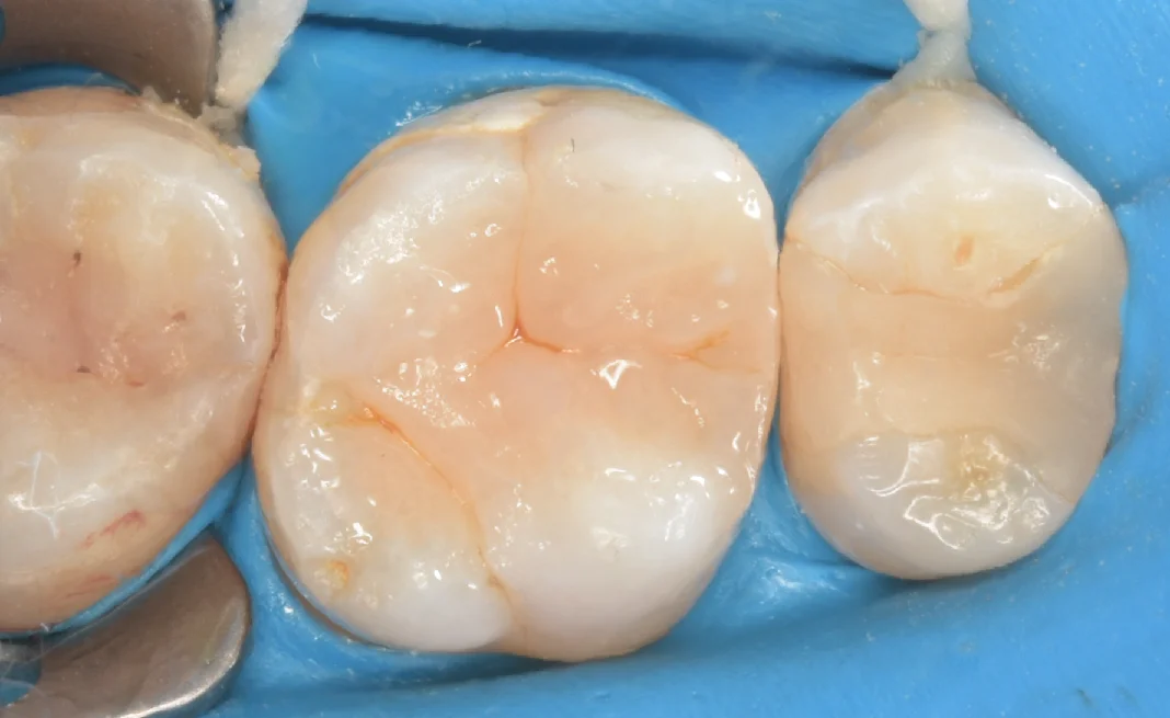 新宿からお越しの方|坂寄歯科医院(取手市藤代) - 画像4