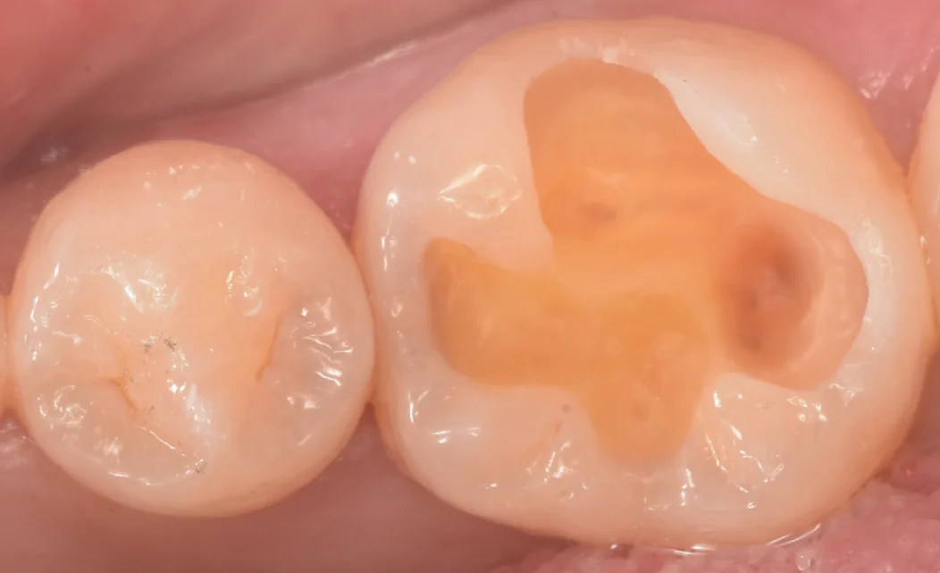 印西からお越しの方|坂寄歯科医院(取手市藤代) - 画像4