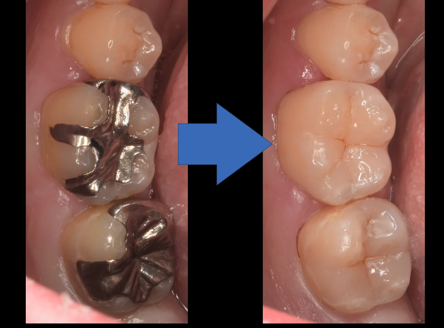 市川市からお越しの方。｜坂寄歯科医院（取手市藤代） - 画像4