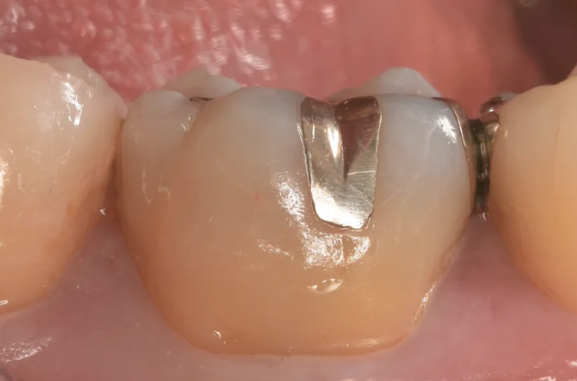 栃木県からお越しの方。｜坂寄歯科医院（取手市藤代） - 画像4