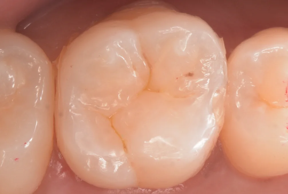 印西からお越しの方。|坂寄歯科医院(取手市藤代) - 画像5