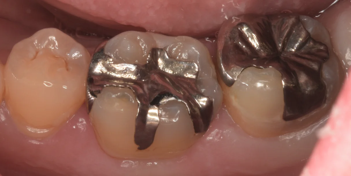 市川市からお越しの方。｜坂寄歯科医院（取手市藤代）