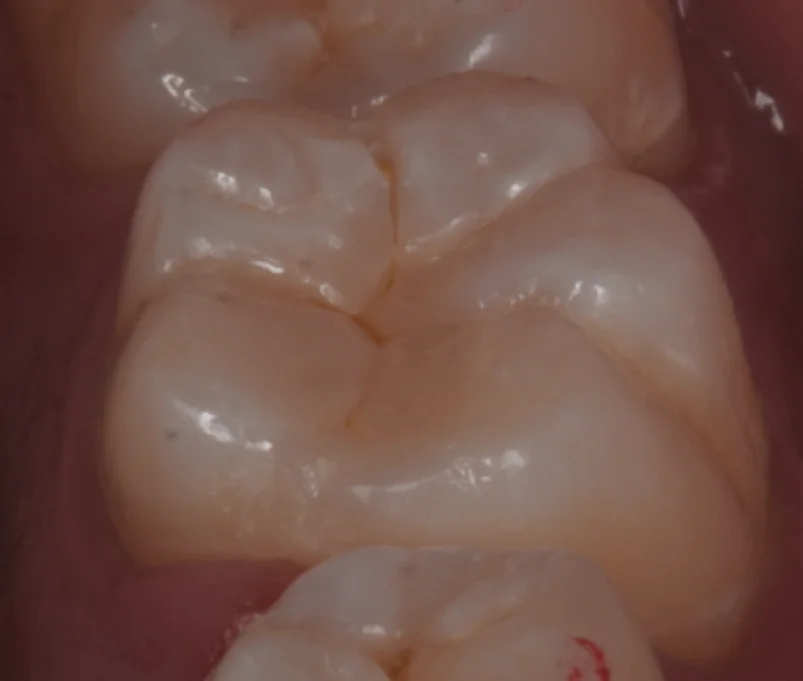 歯学部生をダイレクトで。|坂寄歯科医院(取手市藤代) - 画像6