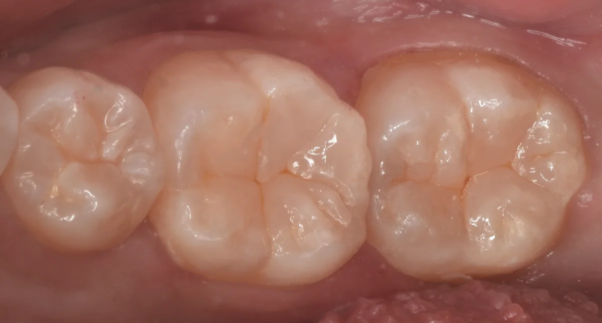 竜ヶ崎市からお越しの方。｜坂寄歯科医院（取手市藤代） - 画像4