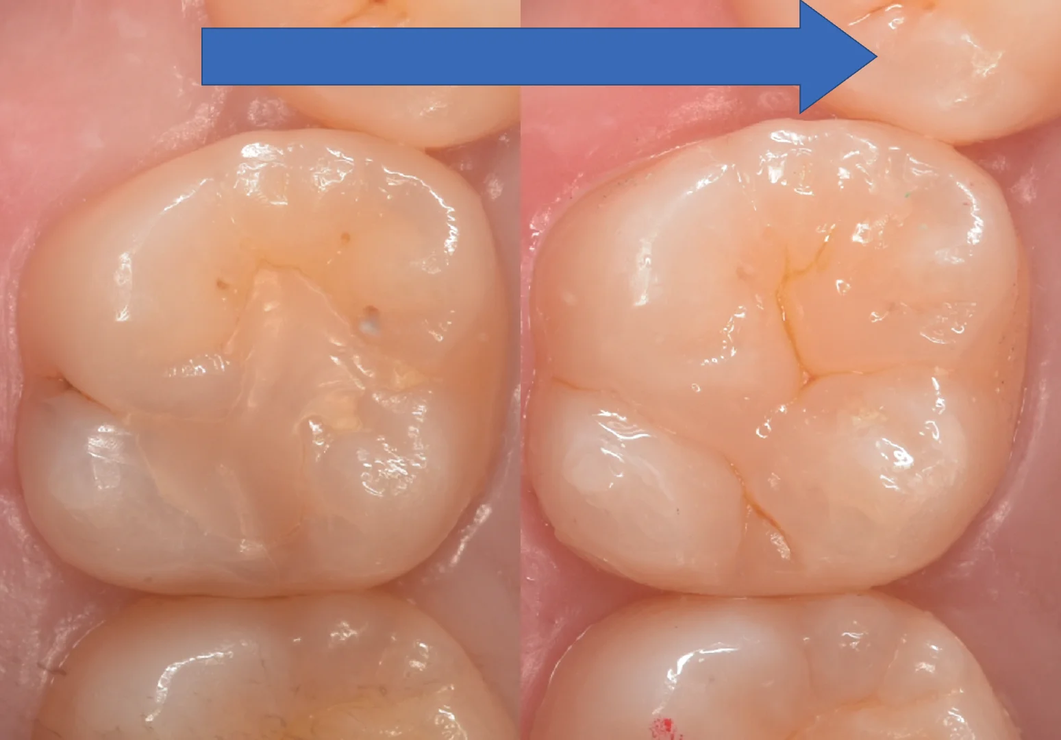 浦安からお越しの方。|坂寄歯科医院(取手市藤代) - 画像8