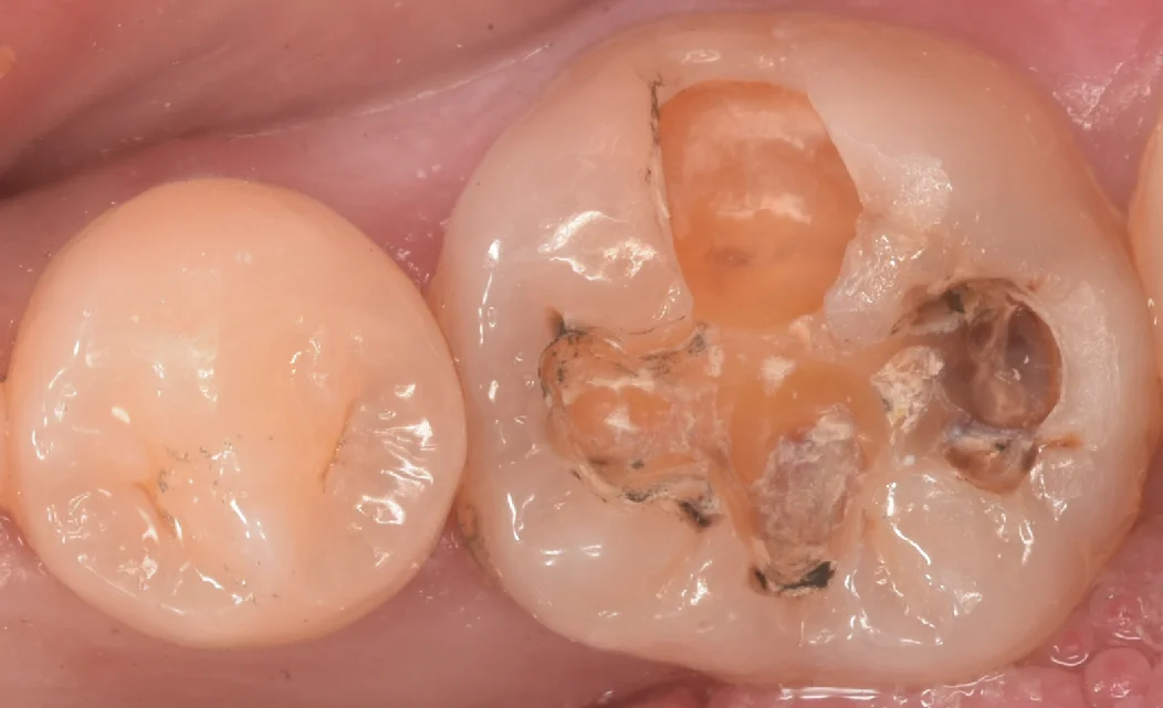 印西からお越しの方|坂寄歯科医院(取手市藤代) - 画像3