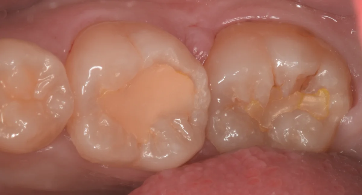 竜ヶ崎市からお越しの方。｜坂寄歯科医院（取手市藤代）