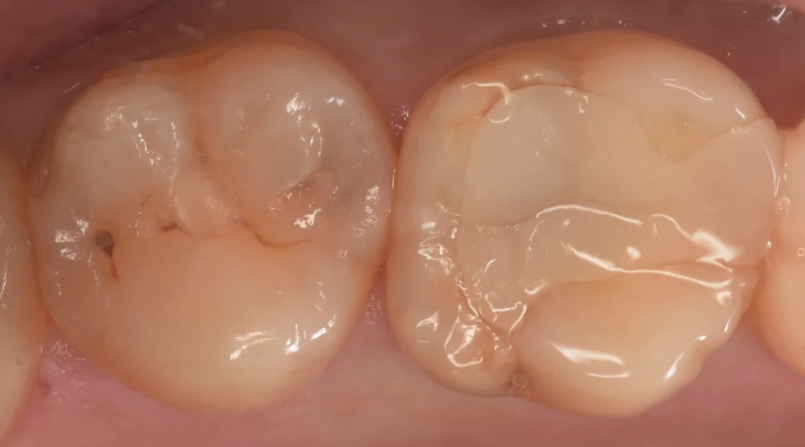 他県より来院された方。｜坂寄歯科医院（取手市藤代）
