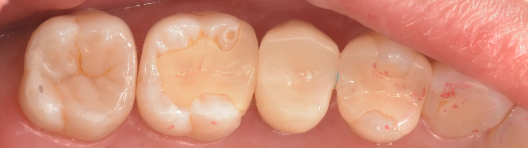 足立区からお越しの方。|坂寄歯科医院(取手市藤代) - 画像7