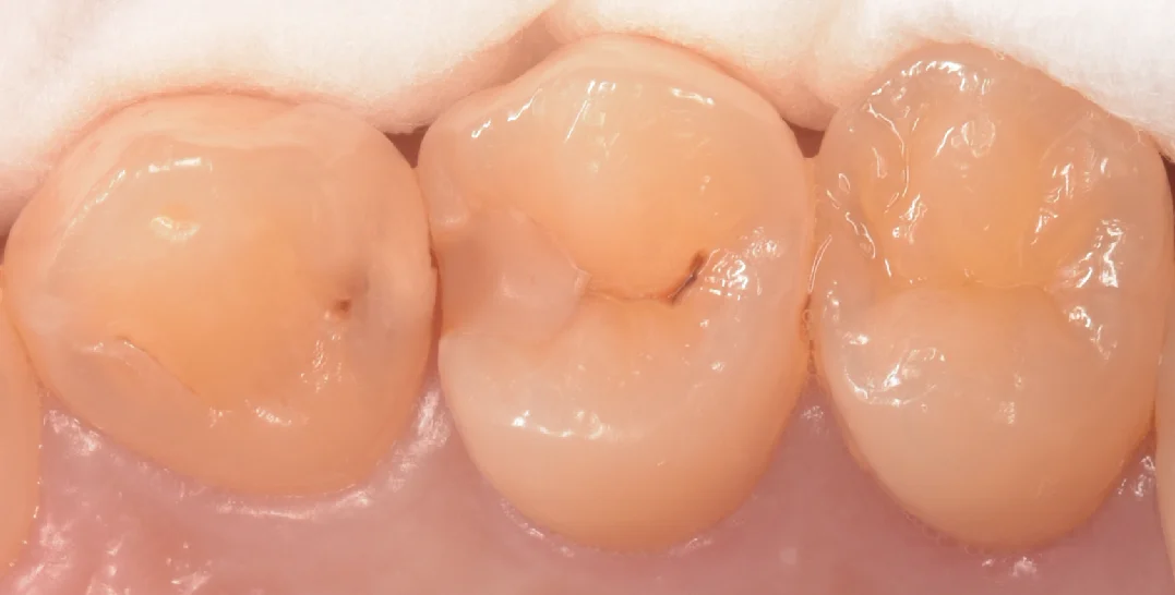 千葉からお越しの歯科衛生士さん。|坂寄歯科医院(取手市藤代)