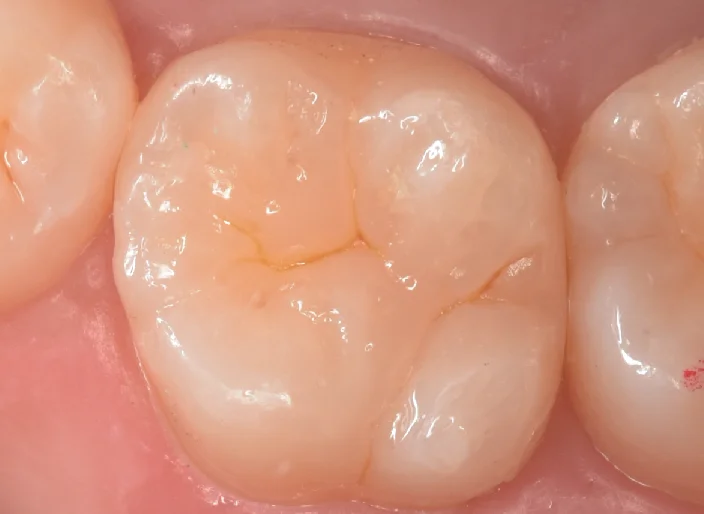 浦安からお越しの方。|坂寄歯科医院(取手市藤代) - 画像7