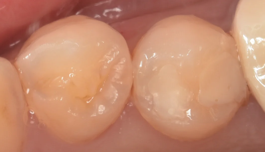 東京都からお越しの方｜坂寄歯科医院（取手市藤代）