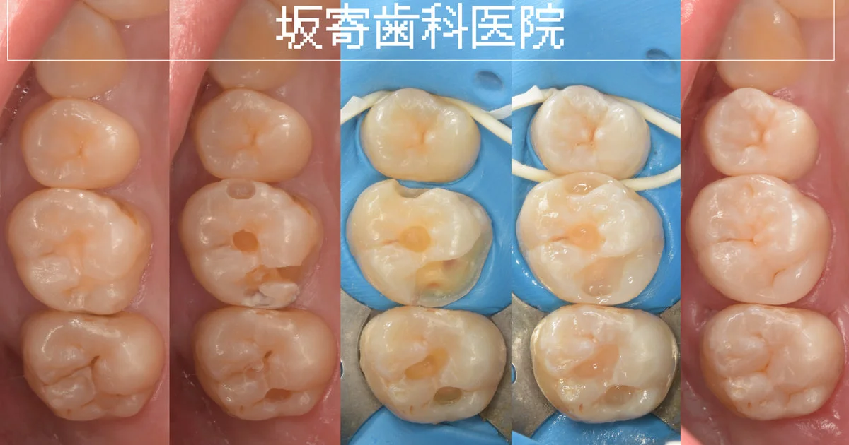 ブログ・お役立ち情報｜坂寄歯科医院（取手市藤代）