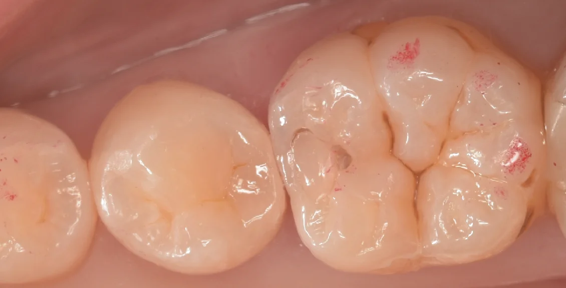 東京都内よりお越しの方をダイレクトで。|坂寄歯科医院(取手市藤代) - 画像4