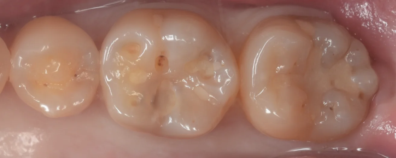 遠方からいらっしゃった歯科医師の方。|坂寄歯科医院(取手市藤代)