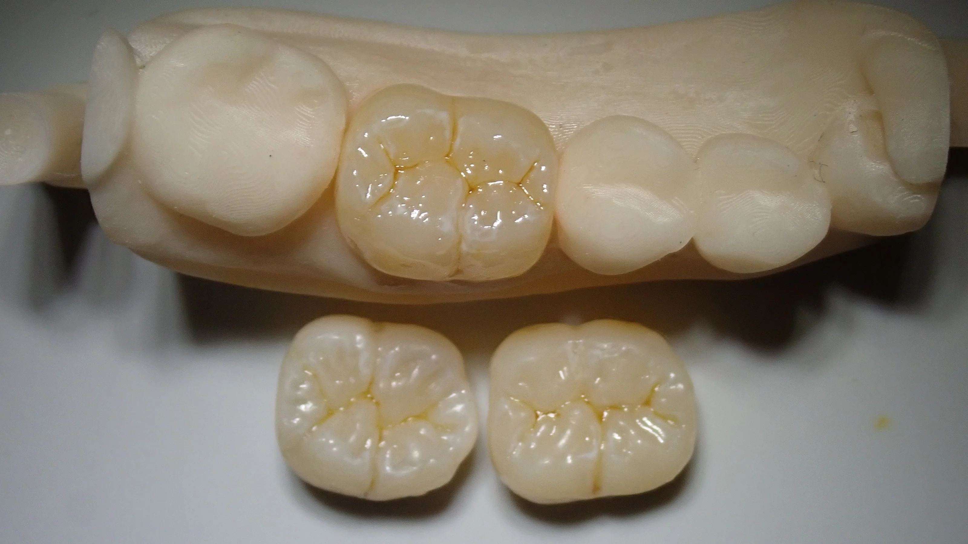 解剖学的知識を深め、更に治療精度を高めるために･･･｜坂寄歯科医院（取手市藤代）