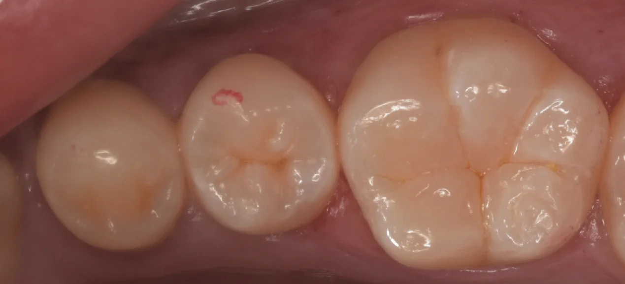 歯学部生をダイレクトで。|坂寄歯科医院(取手市藤代) - 画像5