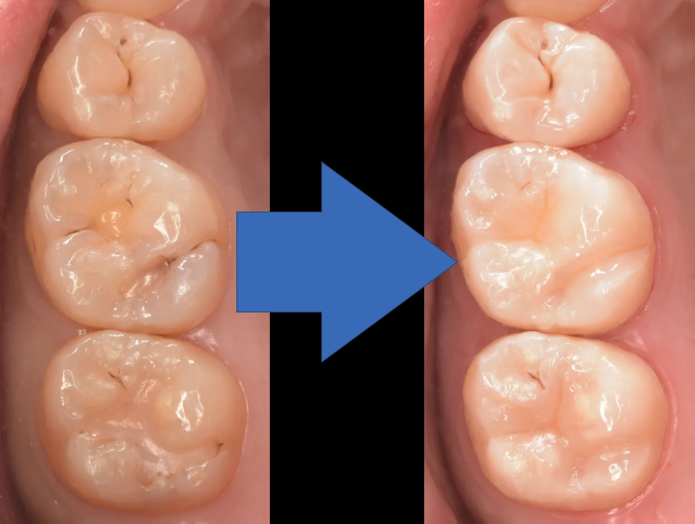 大田区からお越しの方｜坂寄歯科医院（取手市藤代） - 画像5