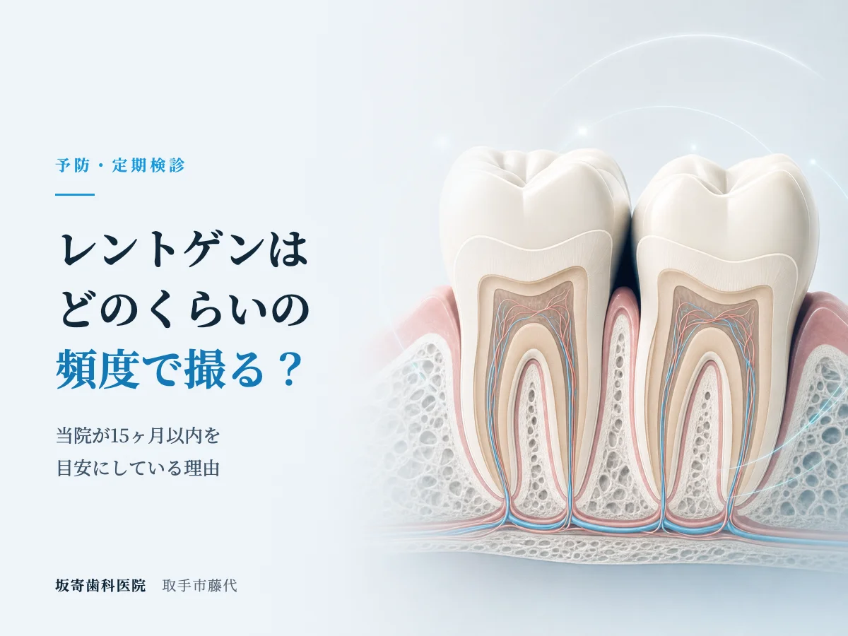 歯医者のレントゲンはどのくらいの頻度で撮る？当院が15ヶ月以内を目安にする理由